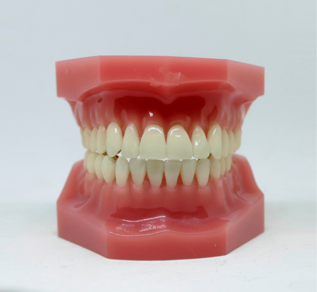 Bone Grafting for Dental Implants in Burlington