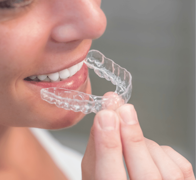 Early Orthodontic Assessment