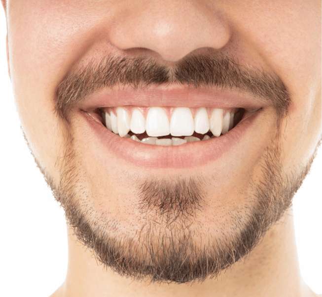 Full Mouth Reconstruction in Burlington