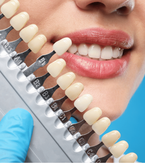 teeth whitening burlington