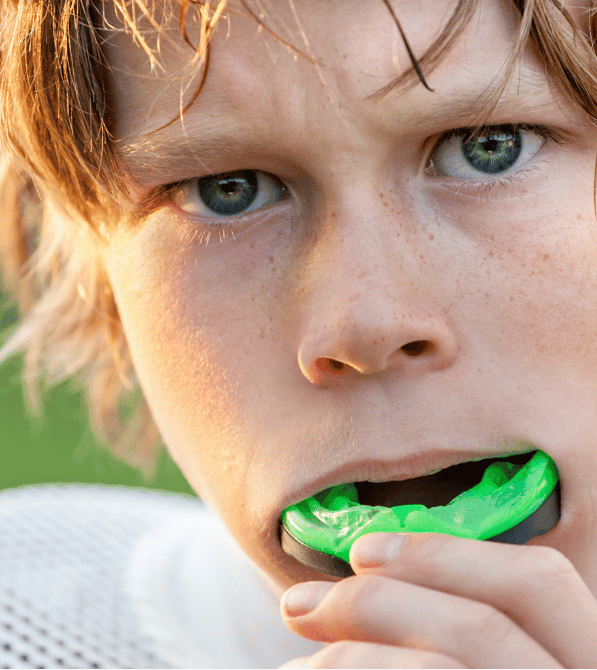 Sports Mouth Guards in Burlington
